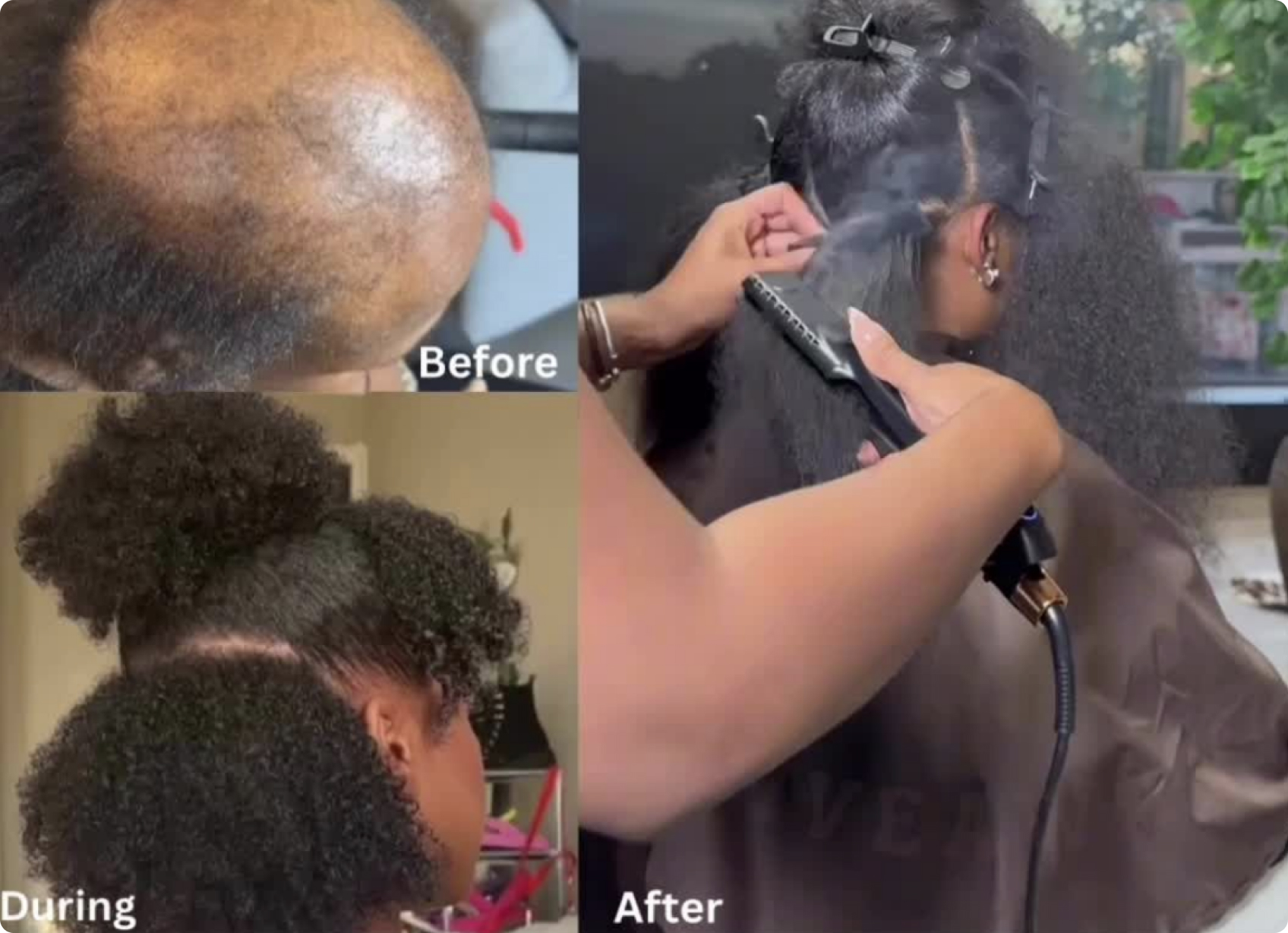 Before, during and after the hair growth transformation